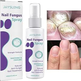Nail Fungus Spray