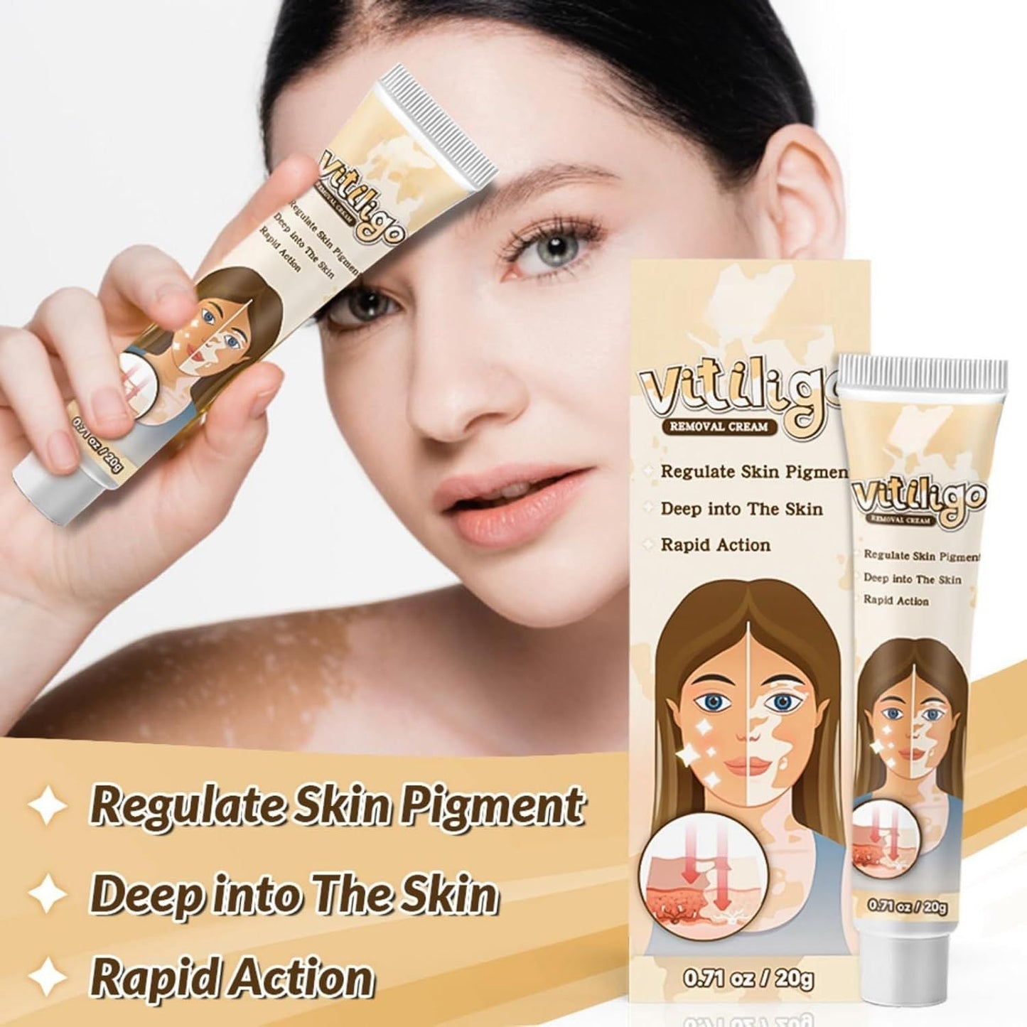 Vitiligo Removal Cream